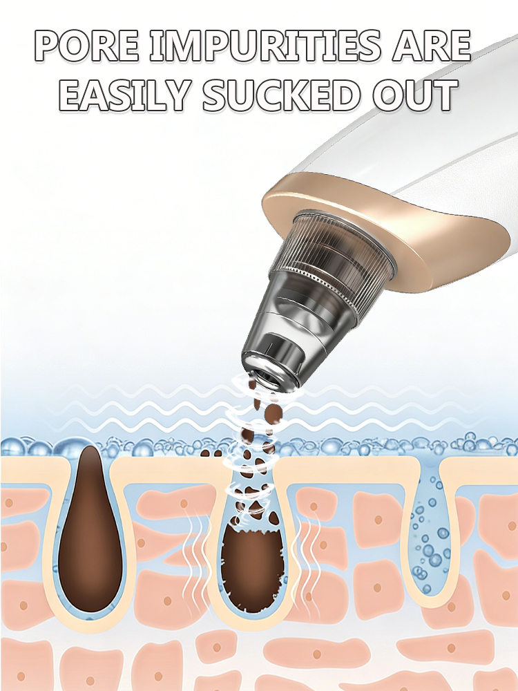 黒ずみ除去毛穴クリーナー黒点吸引器肌ニキビ除去器フェイシャル - Pore Vacuum のレビューと価格