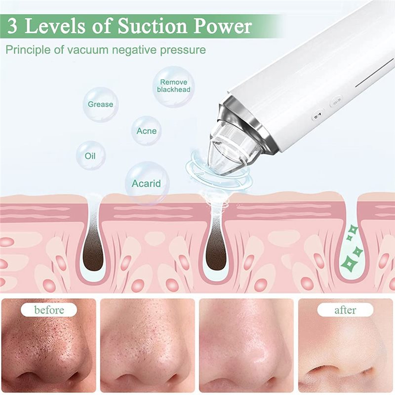 【FITTING】黒ずみ除去毛穴吸引キット HDカメラ付き、 - Pore Vacuum のレビューと価格
